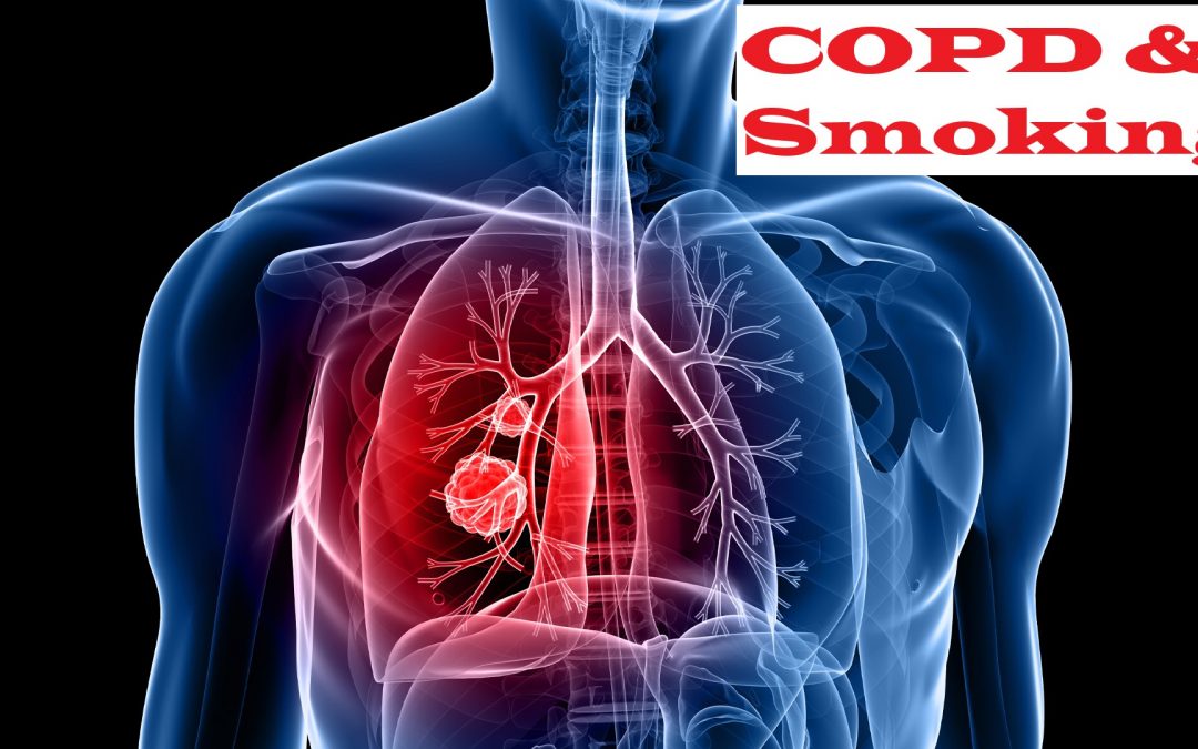 COPD AND SMOKING