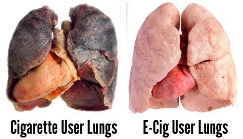 vaping and smoking lungs 